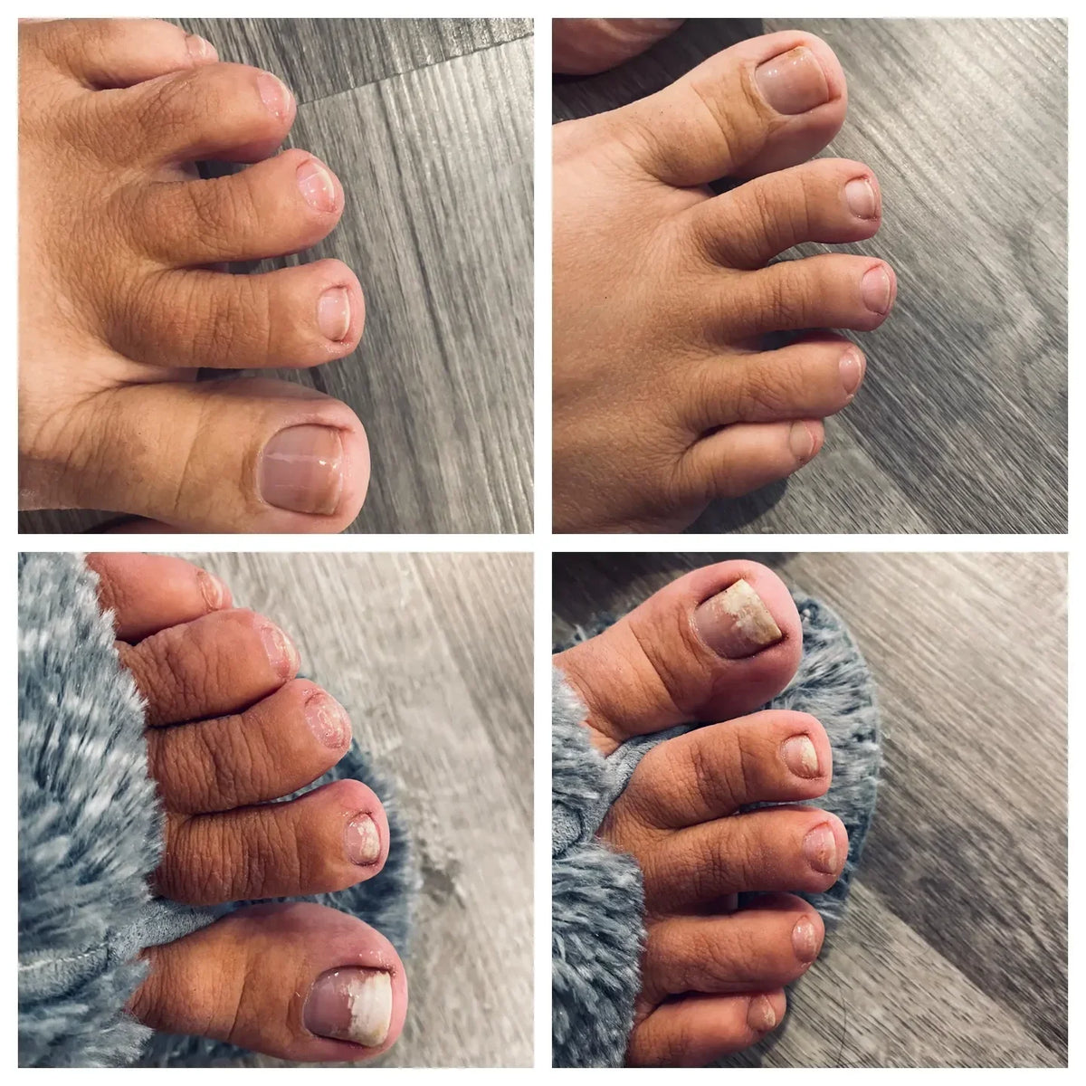 SwissClear Foot Soak - Your path to healthier Nails