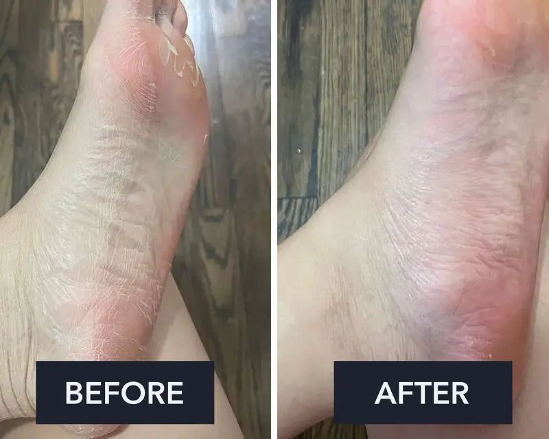 Swissclear Foot Cream