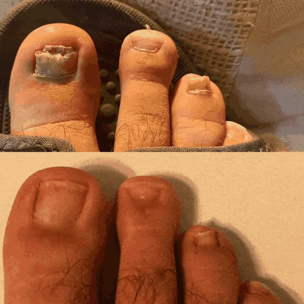 SwissClear Foot Soak - Your path to healthier Nails
