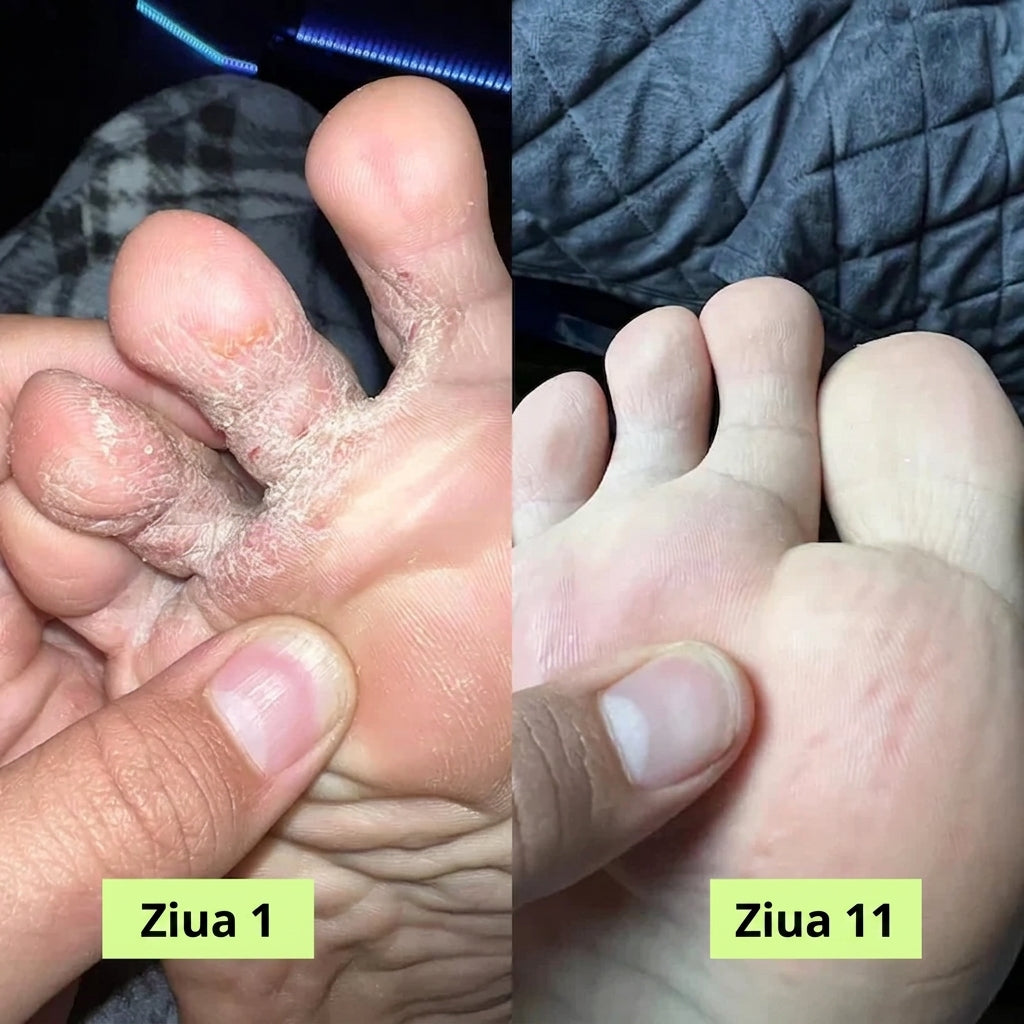Săpun antifungic purificator Medvital®