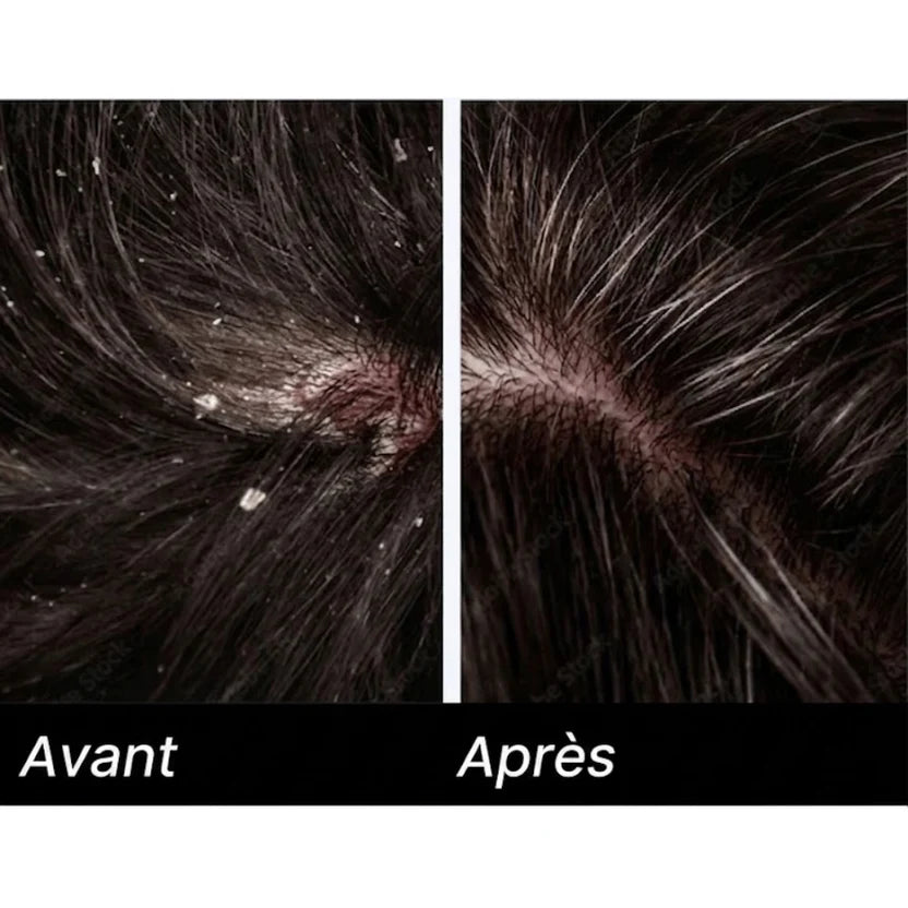 Medvital® Serum Naturel Appaisant